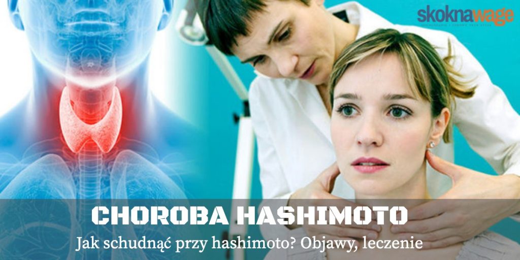 choroba hashimoto